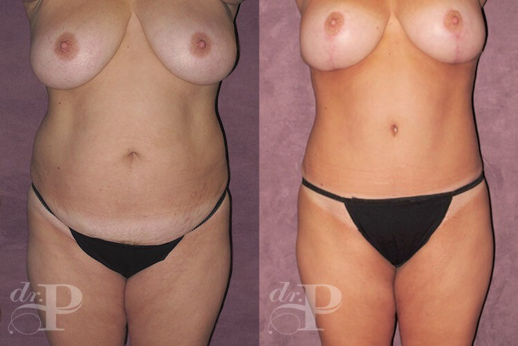  Cambio de Imagen para Mamás Antes y Despues