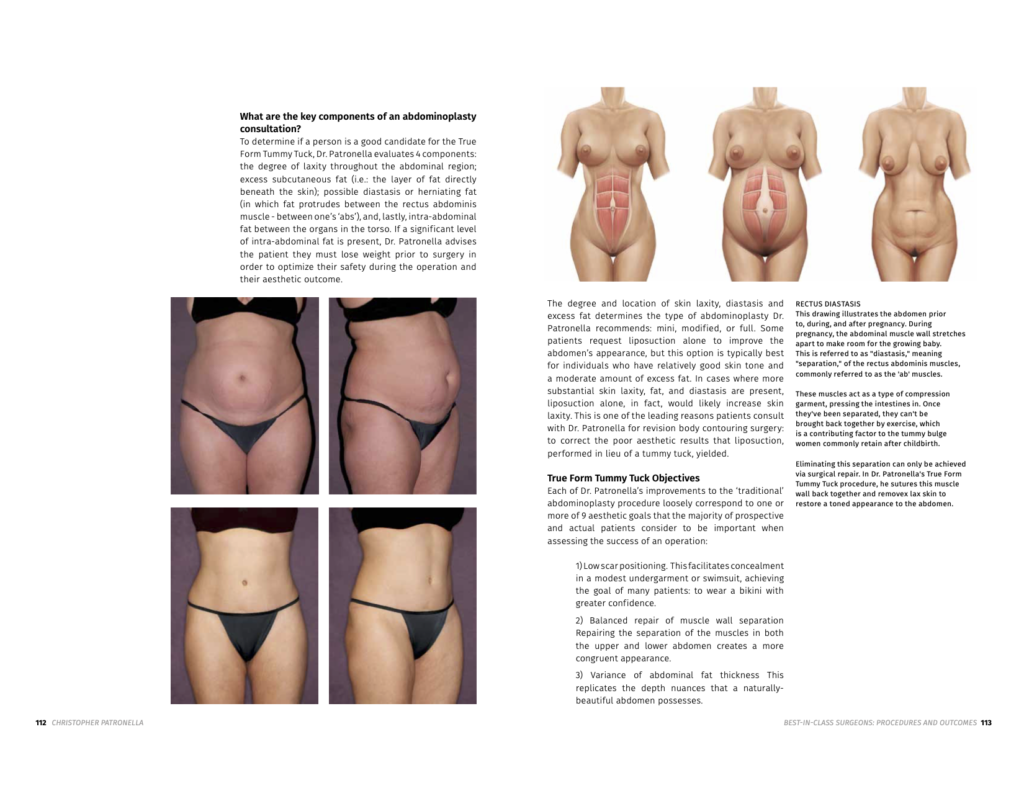 Best-In-Class Surgeons – Procedures and Outcomes in Plastic Surgery (2019)