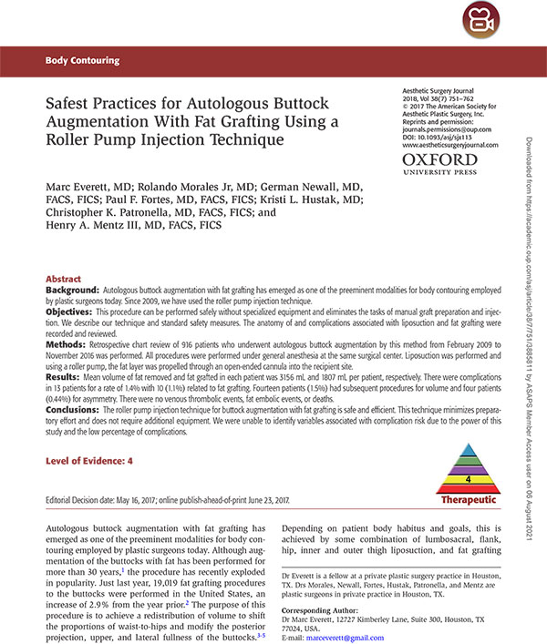 (Brazilian Butt Lift — BBL