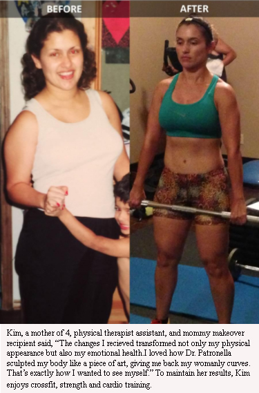 Mommy Makeover Before and After Photos