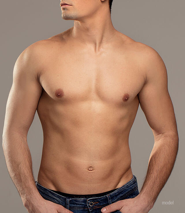 Gynecomastia Surgery (Male Breast Reduction)
