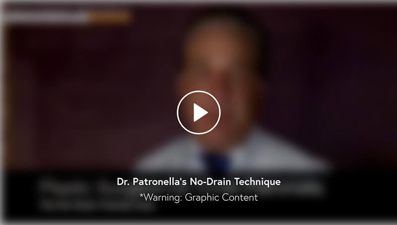 Dr. Patronella's No Drain